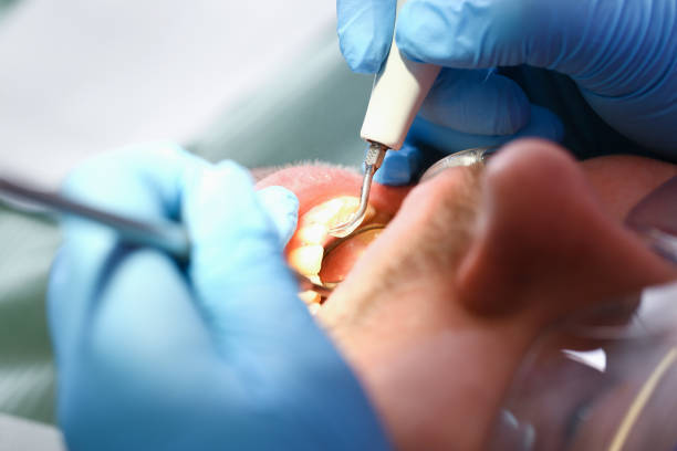 Best Pediatric Emergency Dentist in Fountain, CO